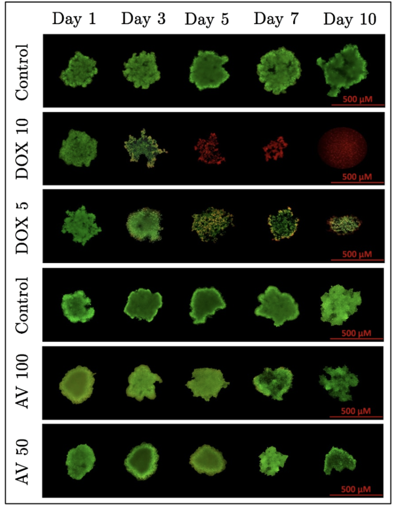 Assessment of Anticancer Effects of Aloe vera on 3D Liver Tumor Spheroids in a Microfluidic Platform